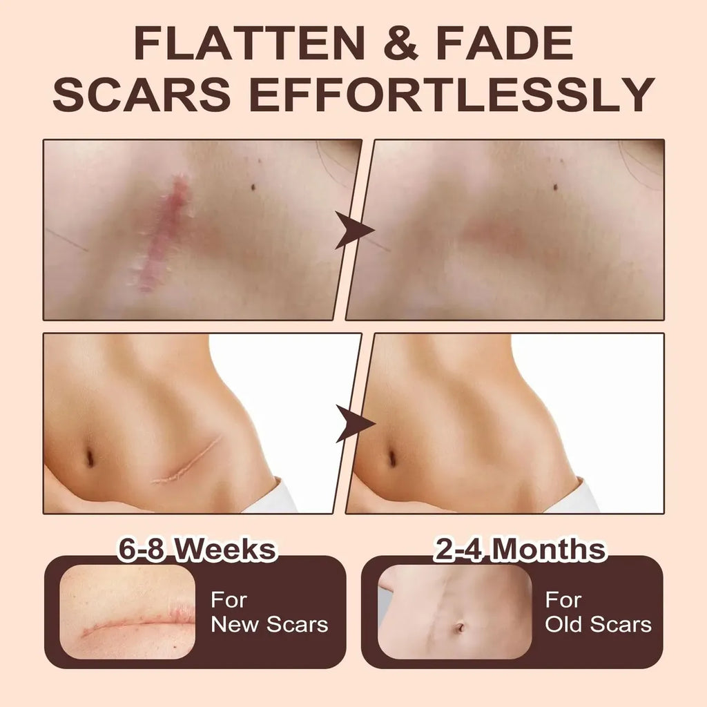 Scar Solutions barra cicatrizante
