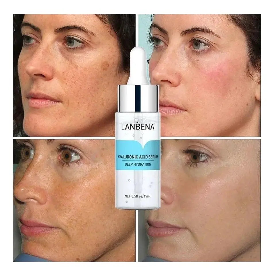 Combo Serums Lanbena