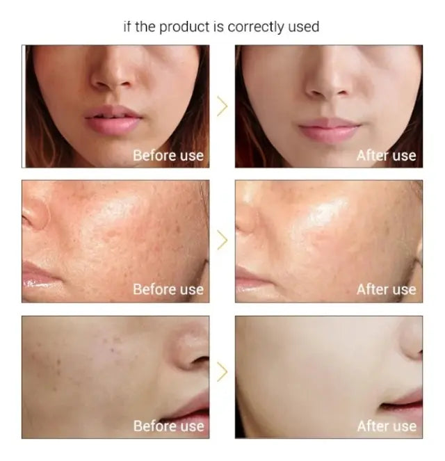 Combo Serums Lanbena